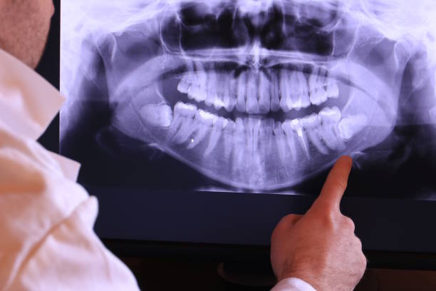 Best Pediatric Emergency Dentist in Zeeland, MI